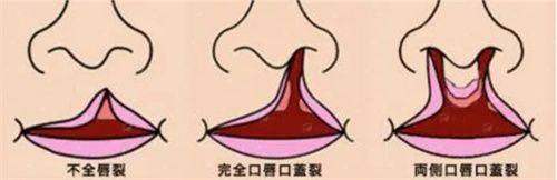 成都鼻修复必看！段焜医生技术特色&审美优势深度揭秘，线上预约挂号已开启-新颜智尚小程序一键预约！