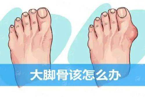 <strong>二、广州广大PEEK 3D打印适合改善哪些部位？成效如何？</strong>