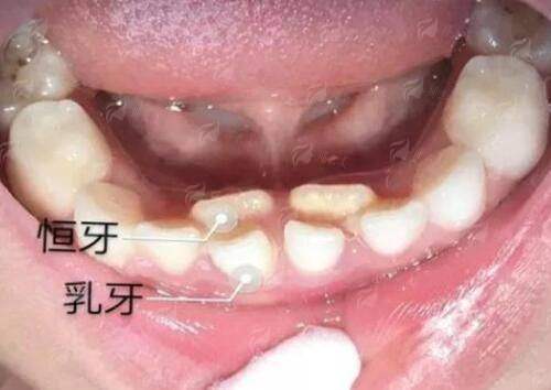 <strong>三、哈尔滨名大在大脚骨手术后的修复与护理上做得如何？</strong>