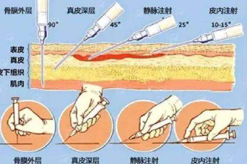 <strong>三、云南昆明韩辰医疗美容医院的双眼皮手术流程与修复期是怎样的？</strong>