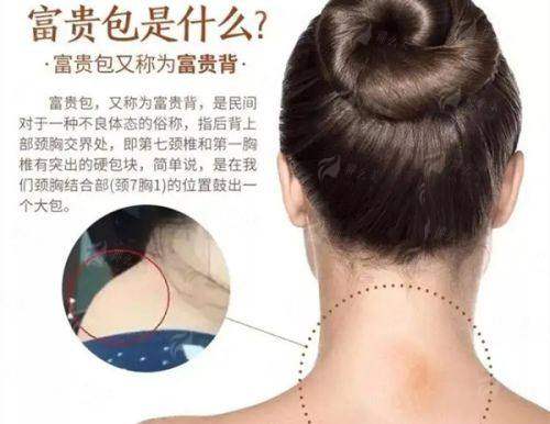 <strong>三、新疆黎美整形美容的大腿吸脂价格与修复过程是怎样的？</strong>