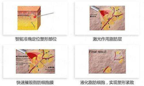 上海张诗若医生简介：眼修复风格优势与口碑分享，线上预约挂号已开启-新颜智尚小程序一键预约！