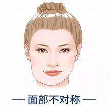 <strong>二、<strong>富贵包是什么意思，怎么消除？</strong>国内有名国有医院的特色方案盘点</strong>