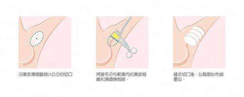 <strong style="color: rgb(255, 0, 0);">医院服务与口碑：从预约到术后护理的全流程体验</strong>