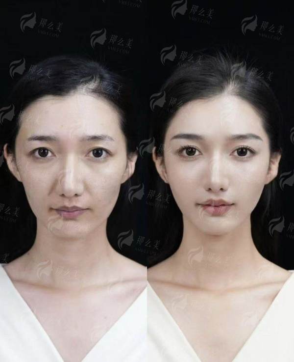 <strong>上海美莱医院：为唐毅隆胸手术提供全方面出色保护</strong>