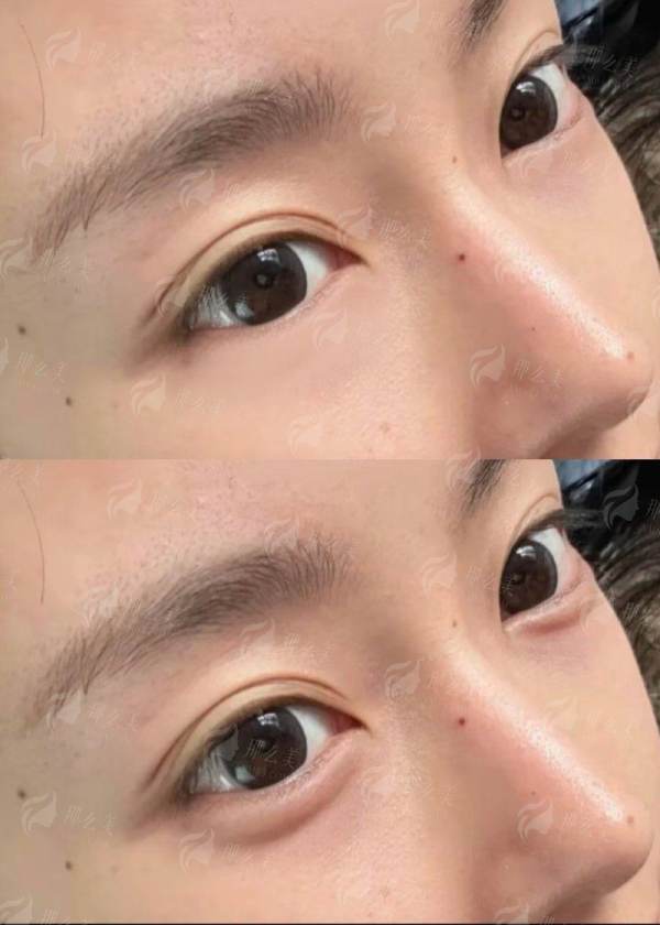 <strong>四、如何选择与预约齐敏医生拉皮？北京惠合嘉美医疗美容有哪些靠谱的预约渠道？</strong>