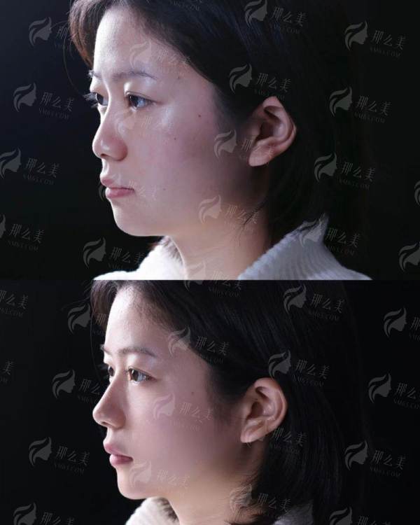 <strong>二、<strong>长沙亚韩整形医院怎么样？——骨干医生与项目深度解析</strong></strong>
