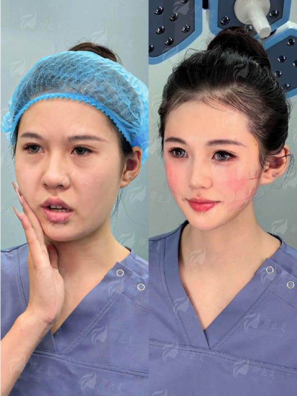 新疆黎美整形美容做大腿吸脂怎么样？医生信息、特色技术及到院路线全解析，小程序预约
