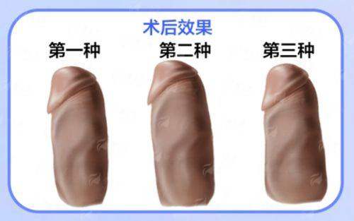 <strong>何鸿智双眼皮风格解析：动态美学的自然派</strong>