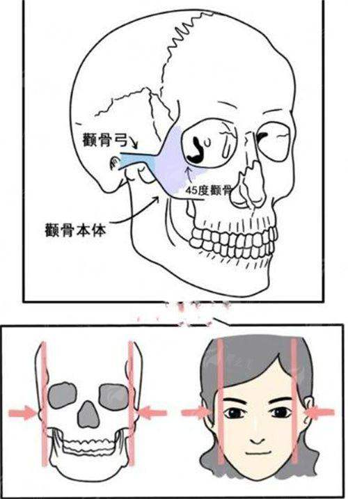 <strong>追求极致妈生鼻，鸿瑞西晶有哪些特色仪器保驾护航？</strong>