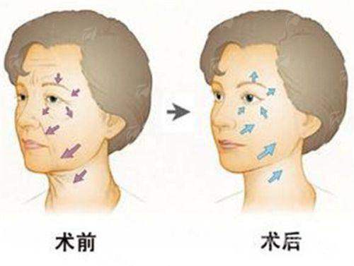 <strong>房志强院长的鼻型设计思路：一场精密的“面部建筑学”规划</strong>