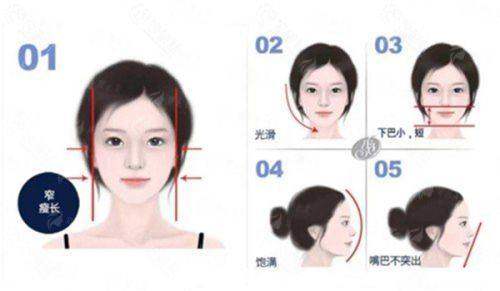 <strong>乌鲁木齐伊丽莎白整形假体隆胸的特色技术解析</strong>