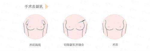 <strong>上海时光面部吸脂骨干医生团队:技术不错是安心与成效的根本保护</strong>