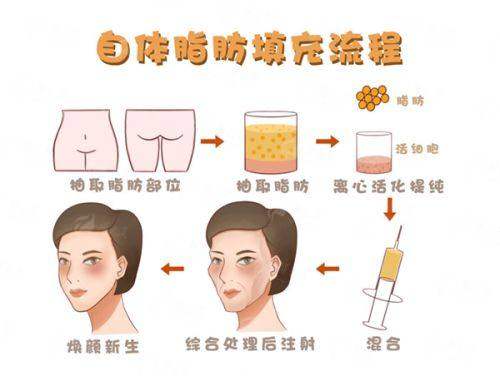 成都吸脂找李烈？恒博天姿医生简介+特色项目解析，新颜智尚小程序一键预约省心快速