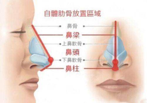 上海伯思立王艳隆鼻价格表&案例实拍，机构地址&乘车路线指引，预约挂号已开启-新颜智尚小程序一键预约！