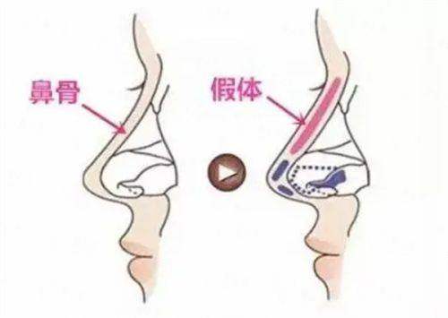 <strong>服务质量与术后护理:专精护航修复全过程</strong>