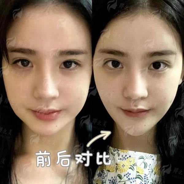 <strong>毛囊成活细节全公开：从提取到种植的“生命保护”链</strong>