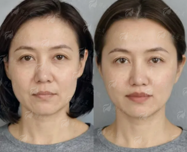 <strong>骨干医生团队实力：成效背后的核心保护</strong>