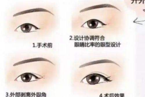 <strong>二、<strong>武汉美基元的面部提升技术有哪些独到之处？</strong></strong>
