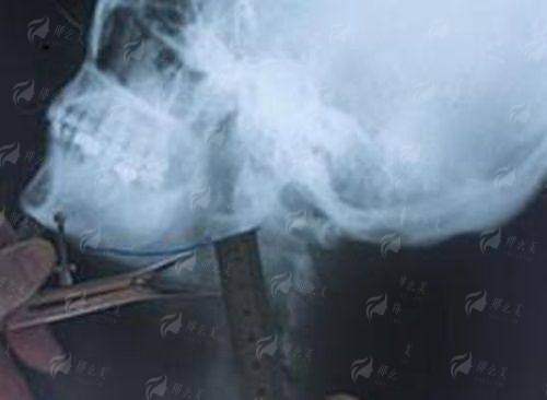 <strong>符合你的个性曲线：八大处骨干医生的特殊塑鼻技艺</strong>