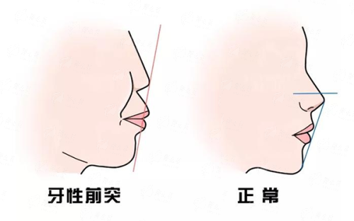 <strong>四、如何预约北京加减美医疗美容中 心的黄寅守拉皮手术？</strong>
