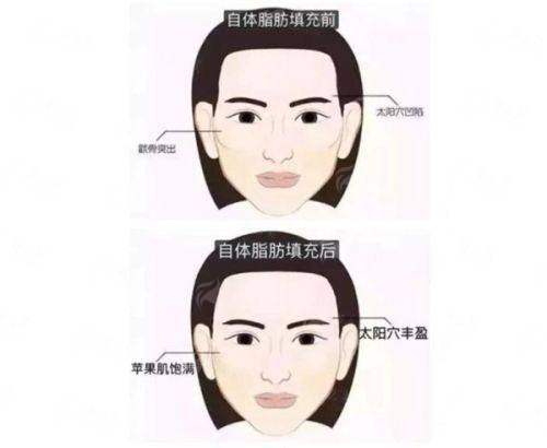 <strong>二、选择沈阳百嘉丽做王新磊眼修复有哪些独特优势？</strong>