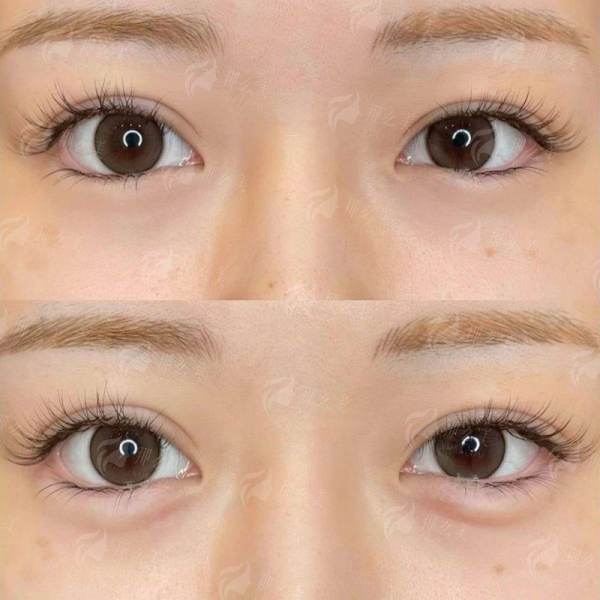 <strong>八大处耳软骨隆鼻全攻略看这：从设计思路到术后反馈的完整链条</strong>