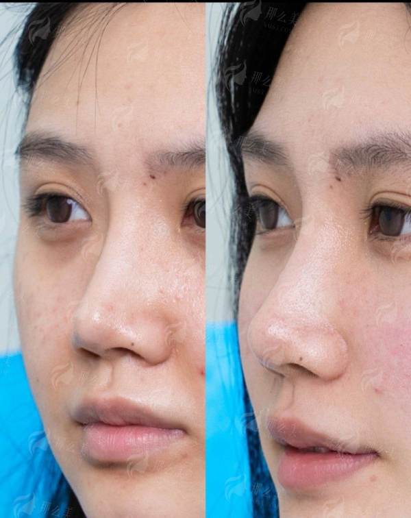 <strong>南京施尔美孙欣双眼皮怎么样？——医院实力与特色项目保驾护航</strong>