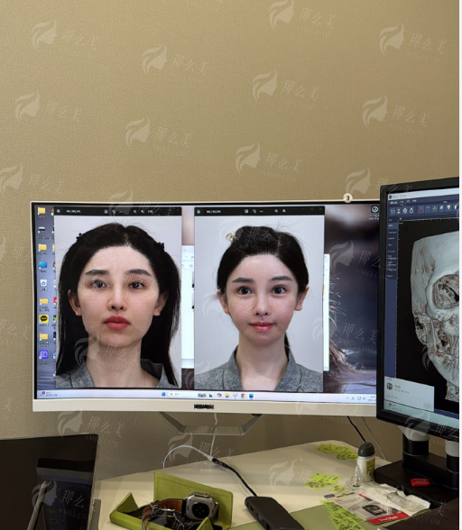 <strong>重庆美仑美奂特色仪器如何为体雕吸脂塑形保驾护航?</strong>