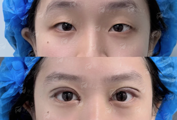<strong>四、郑州东方整形美容医院的贺洁眼修复如何预约与选择？</strong>