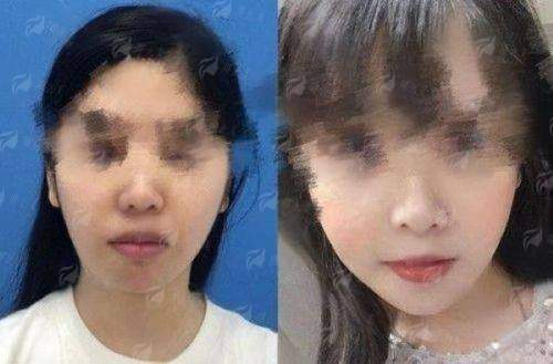 <strong>三、苏州圣爱整形外科医院的唇裂修复服务与流程有什么优势？</strong>