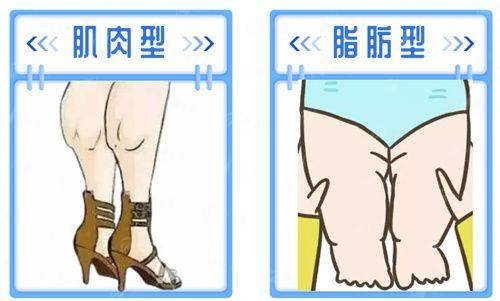<strong>服务质量与术后护理：全程呵护，安心变得更美</strong>