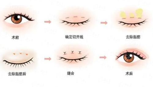 <strong>上海天佑唇部整形的价格与收费标准</strong>