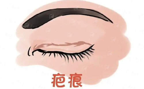 <strong style="color: rgb(255, 0, 0);">广州曙光郑惠院长线提升价格与收费标准详解</strong>