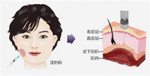 <strong>四、如何选择与预约深圳鹏程医院的疤痕处理服务？</strong>