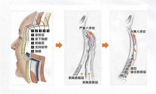 <strong>从预约到术后:北京加减美的全流程服务质量</strong>