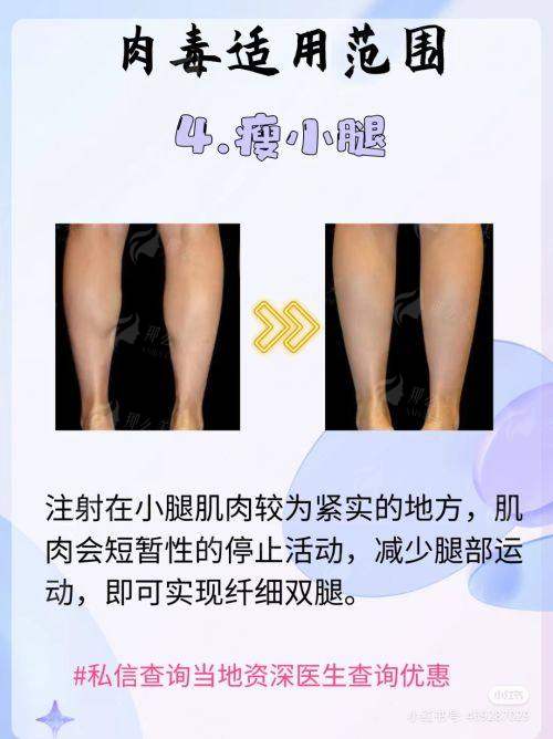 长沙祺美李成：内窥镜隆胸口碑之选，新颜智尚小程序一键预约看详情