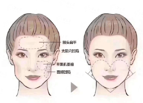 深圳鹏程医院疤痕修复，从价格了解到预约方式全攻略，新颜智尚小程序可约