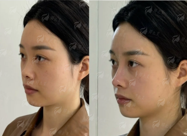 <strong>求美者更关心：上海天佑濡白天使的价格与口碑如何？</strong>
