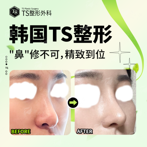 想了解武汉月目祛眼袋价格与效果？附医院介绍及新颜智尚预约方式