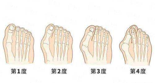 <strong>二、乌鲁木齐华茜医美的“唇矫小切口拉皮”技术有何特点？</strong>