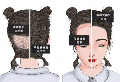 <strong>三、连云港美缔医疗美容做假体隆鼻的价格贵吗?和本地其他机构比如何?</strong>
