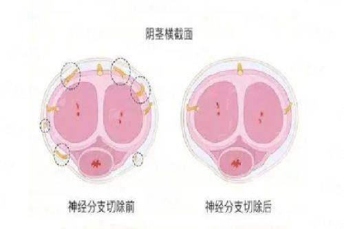 <strong>上海申江医院毛发移植中 心怎么样？服务质量与术后护理是关键</strong>