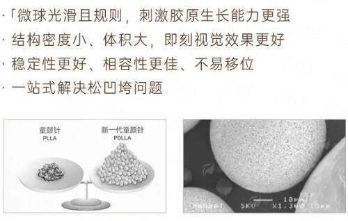 <strong>杭州艺星自然双眼皮的特色治疗方式与仪器</strong>