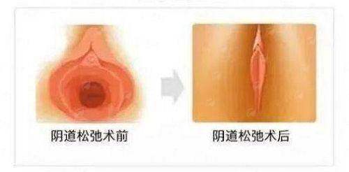 <strong>二、<strong>具有影响力国有医院的全身吸脂理念有何不同？</strong></strong>
