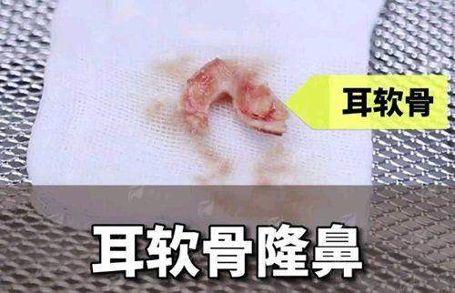<strong>杭州艺星假体隆胸预约挂号全流程指南</strong>