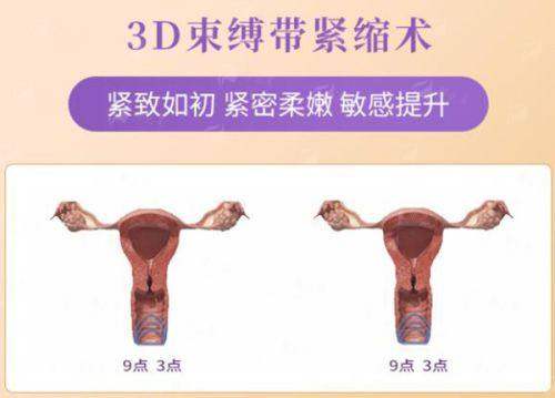 <strong>杭州艺星医疗美容医院的整体环境与服务如何？</strong>