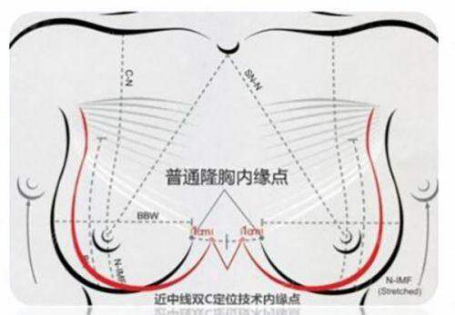 想了解台州维多利亚李如杰隆胸价格与风格？附医院地址与特色项目介绍，新颜智尚小程序预约省心快速