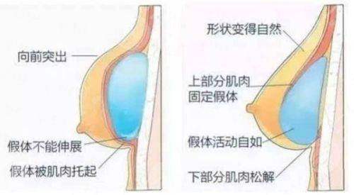 <strong>三、成都密爱天使医疗美容医院的阴道紧致针有什么优势？</strong>
