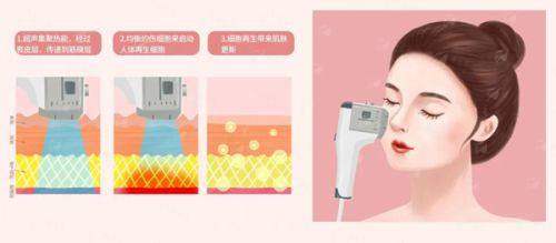 <strong>二、北京美莱万柳医疗美容的塑研萃童颜针技术好吗？</strong>